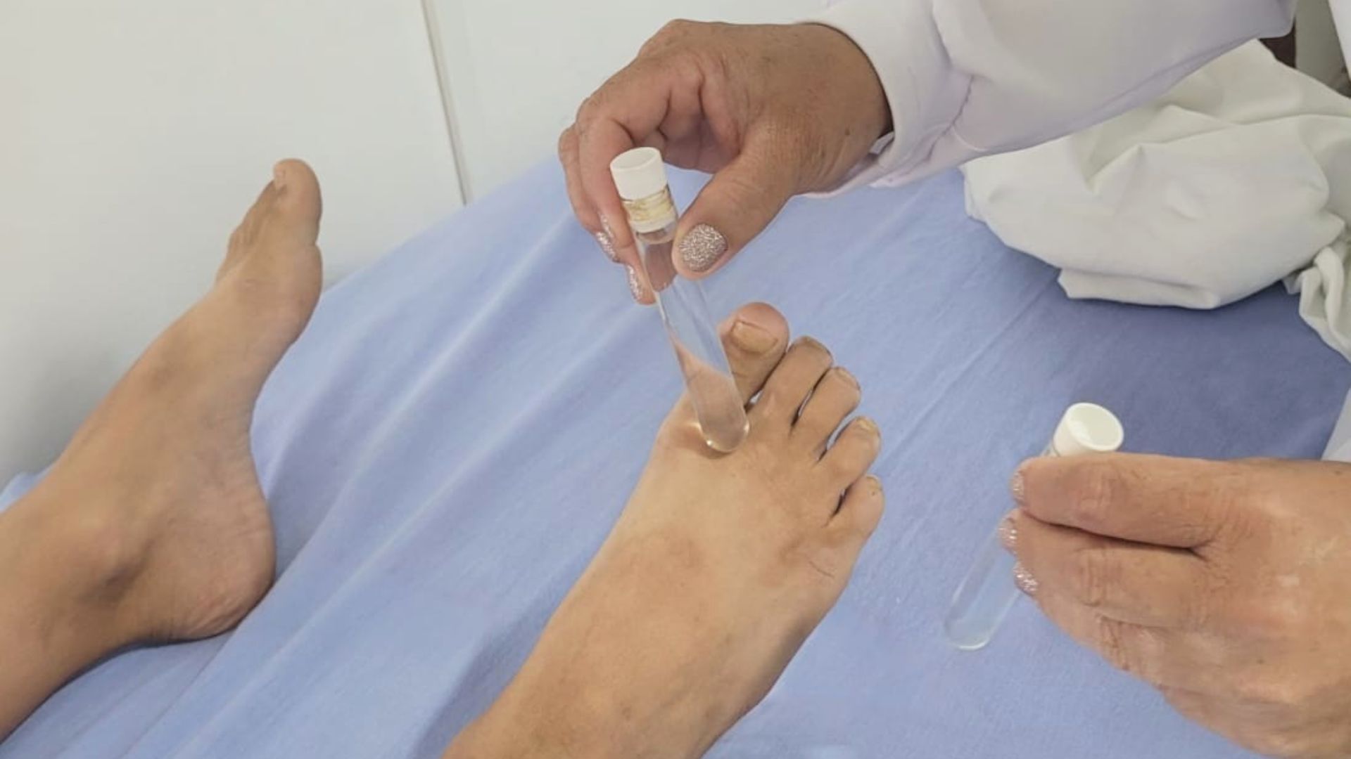 Janeiro Roxo: ações marcam a luta pelo combate à Hanseníase em Água Boa