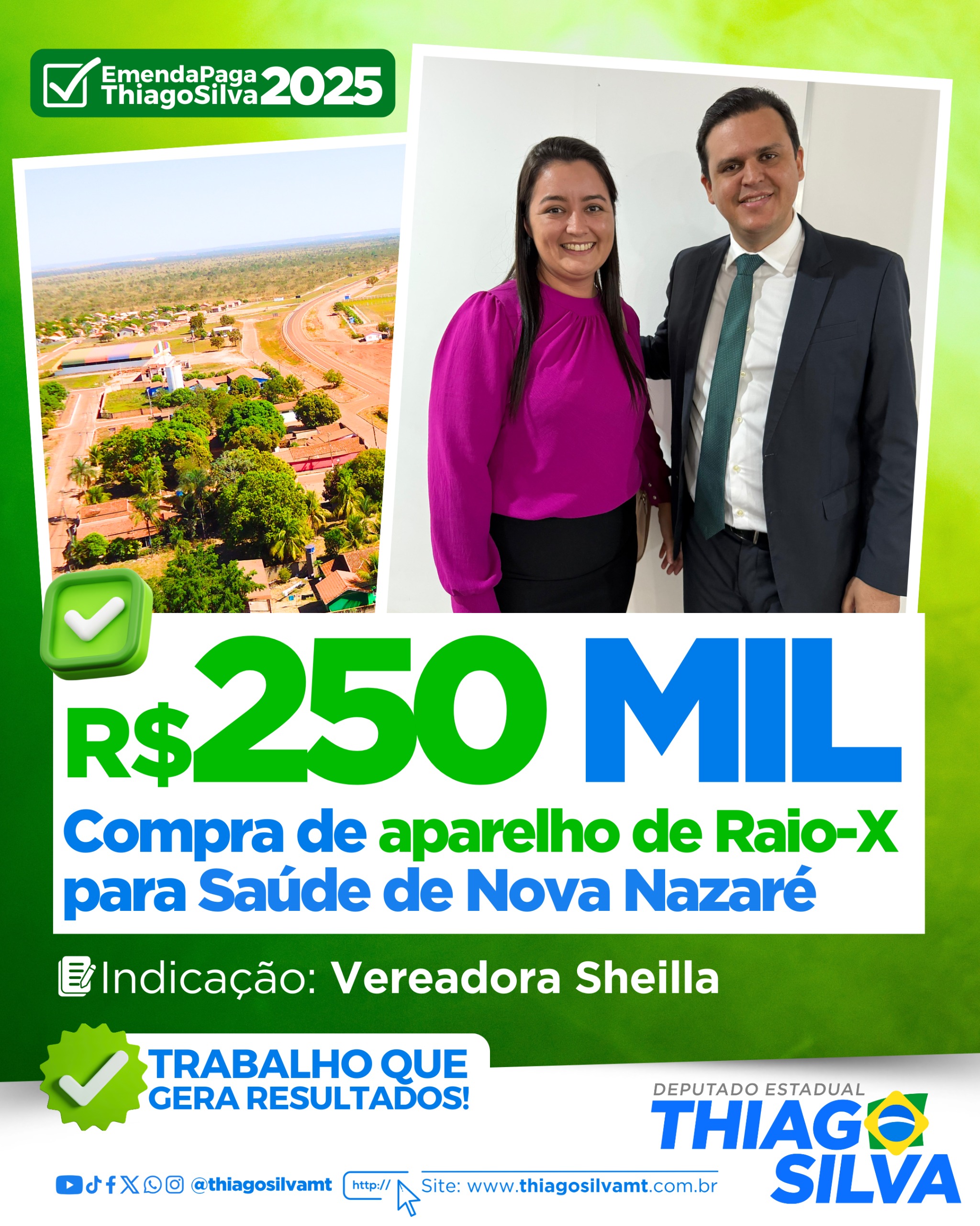 Nova Nazaré recebe aparelho de raio-X adquirido com emenda parlamentar de R$ 250 mil
