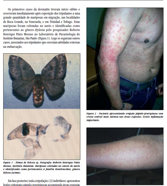 Foto Reprodução Alerta em Querência: áudio sobre mariposa Hylesia causa preocupação, Secretaria de Saúde descarta confirmação