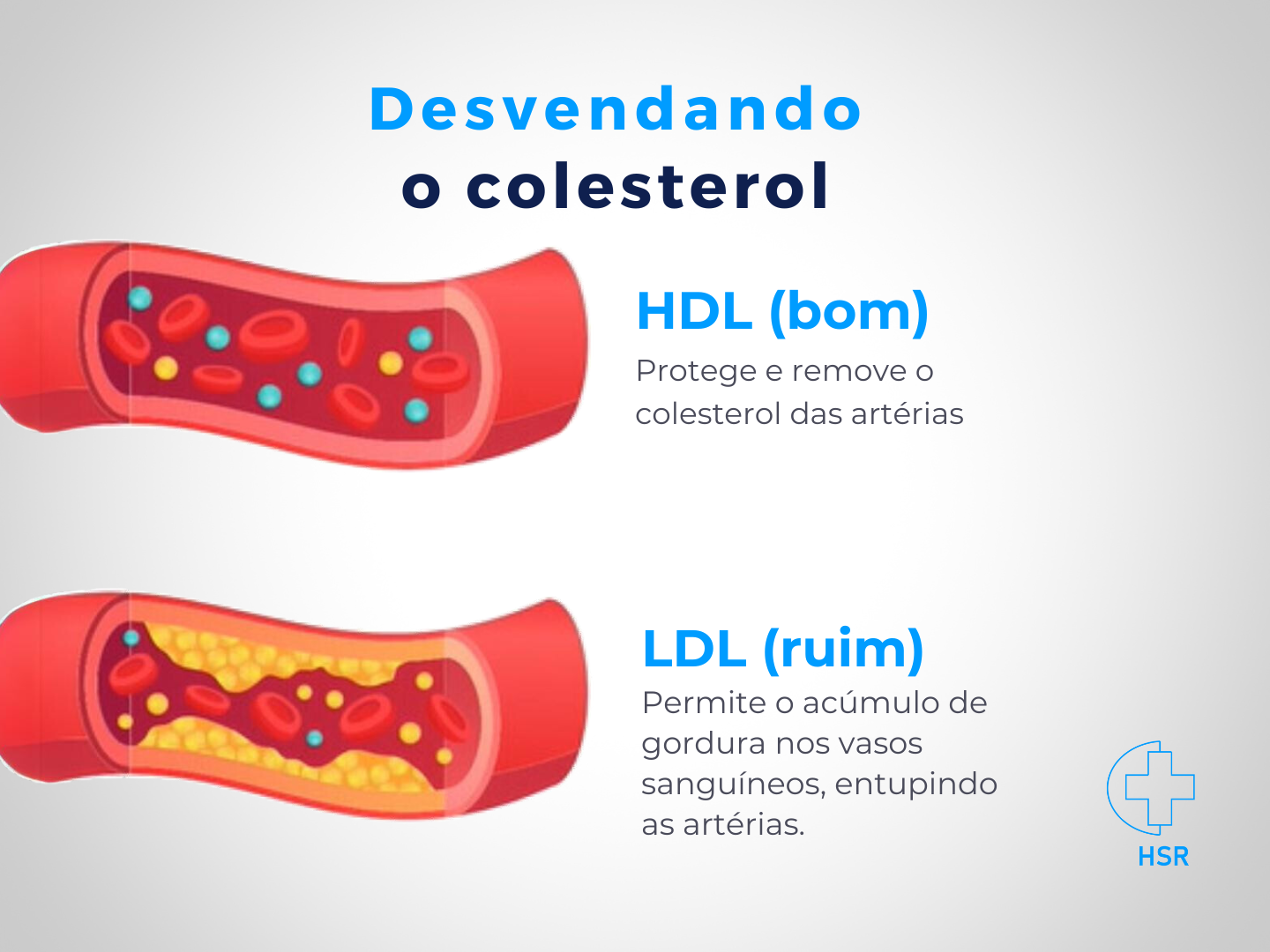 Colesterol alto pode ser descoberto na visão mesmo sem sintomas