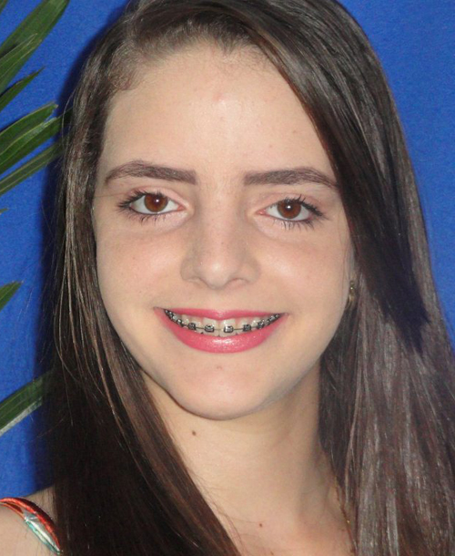 Aléxia Antunes Oliveira - 15 anos